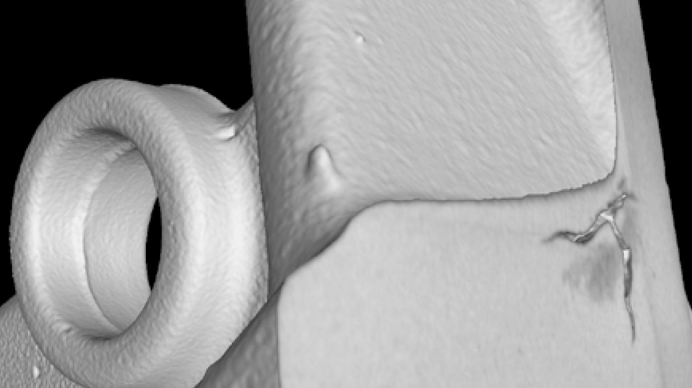 ZEISS Aree spugnose nel metallo leggero