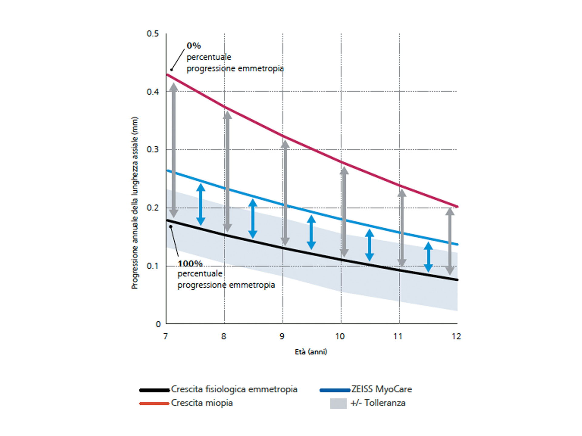 Un grafico a linee mostra la progressione annuale della lunghezza dell’asse, con la crescita emmetrope fisiologica in nero in basso, la crescita miope in rosso in alto e i risultati delle lenti ZEISS MyoCare in blu al centro. Da questo grafico si può dedurre che, indossando le lenti ZEISS MyoCare, la progressione della miopia si mantiene al di sotto della curva di crescita.  