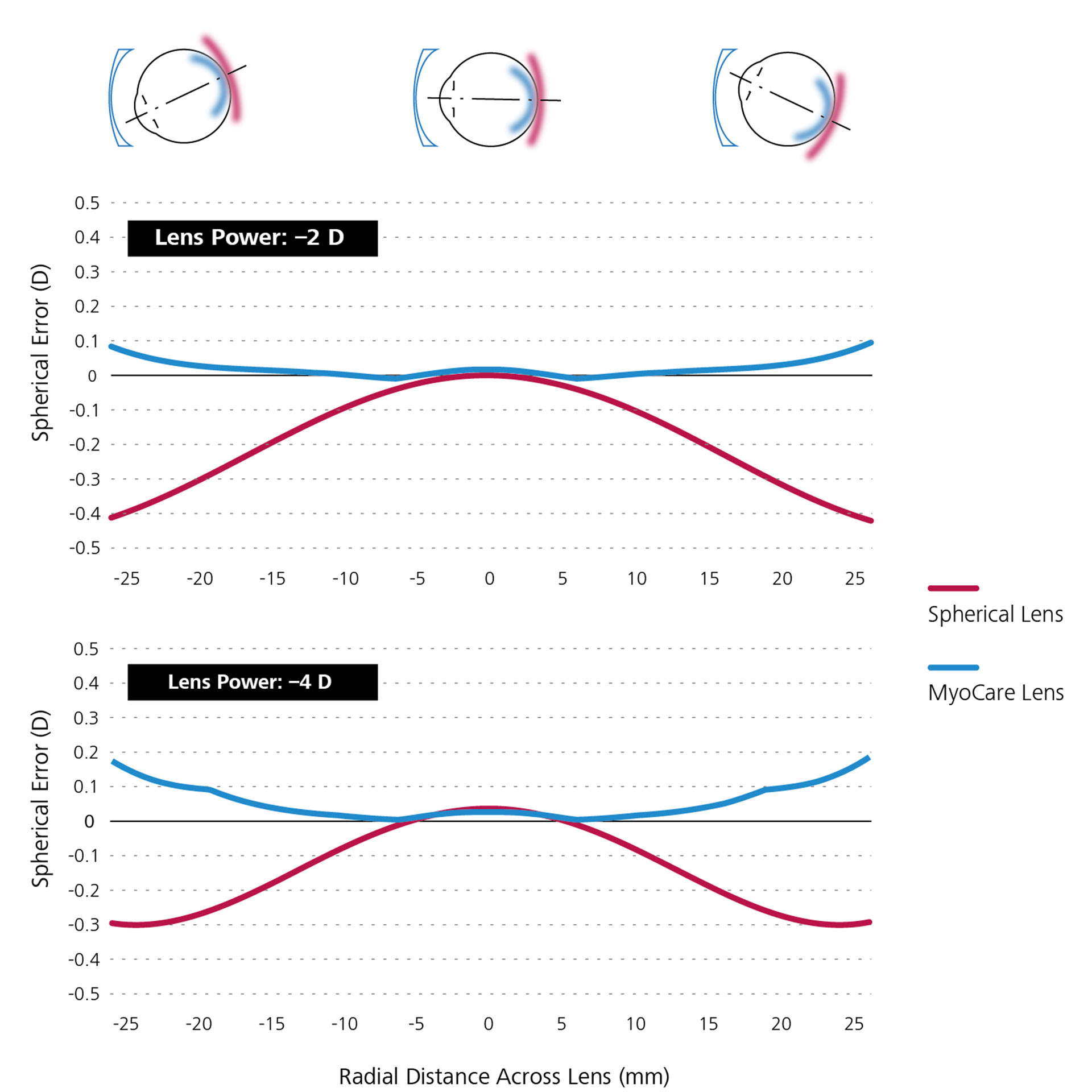 Grafico con due linee che mostra la simulazione matematica comparativa tra le lenti monofocali (in rosso) e le lenti MyoCare (in blu).