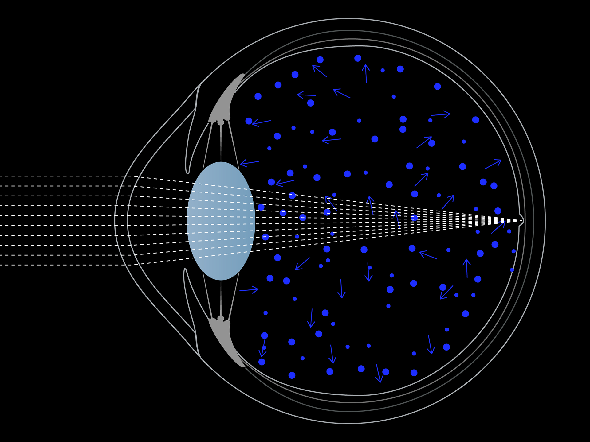Visualizzazione schematica della dispersione della luce blu negli occhi.