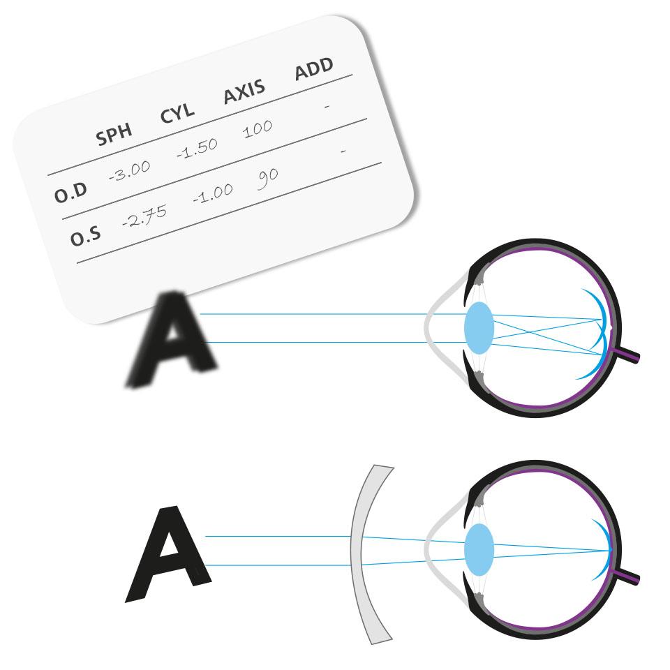 Prescrizione con numeri nelle colonne CYL e AXIS