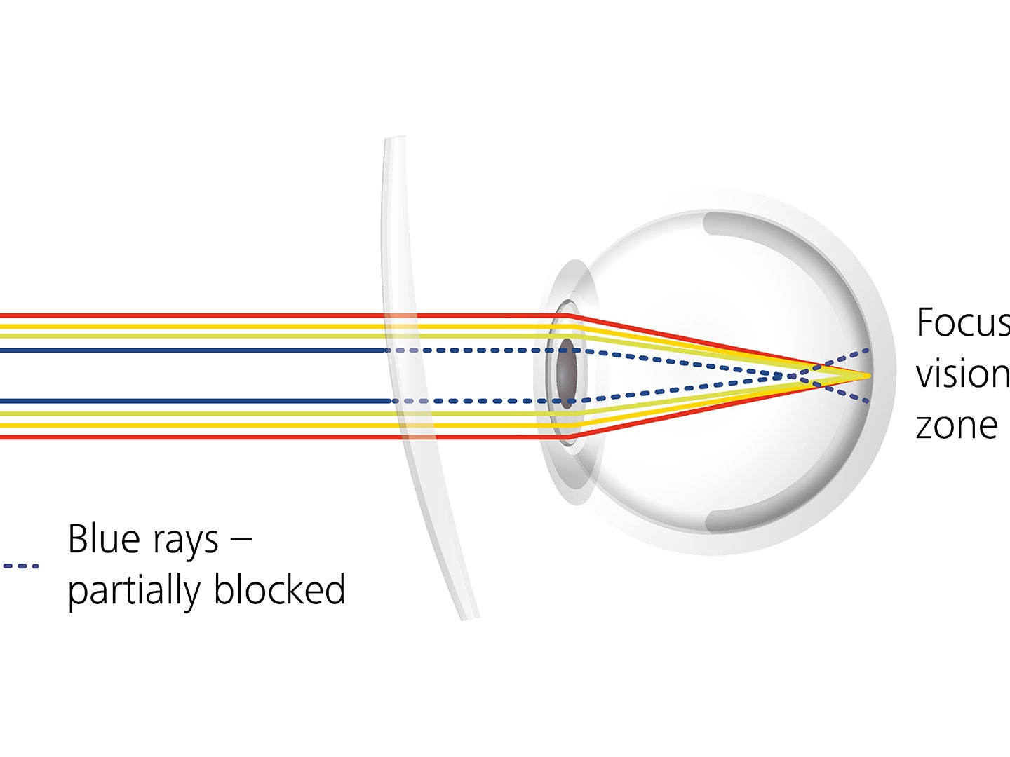 Visualizzazione di come i trattamenti delle lenti possono ridurre l'abbagliamento bloccando parzialmente i raggi blu 