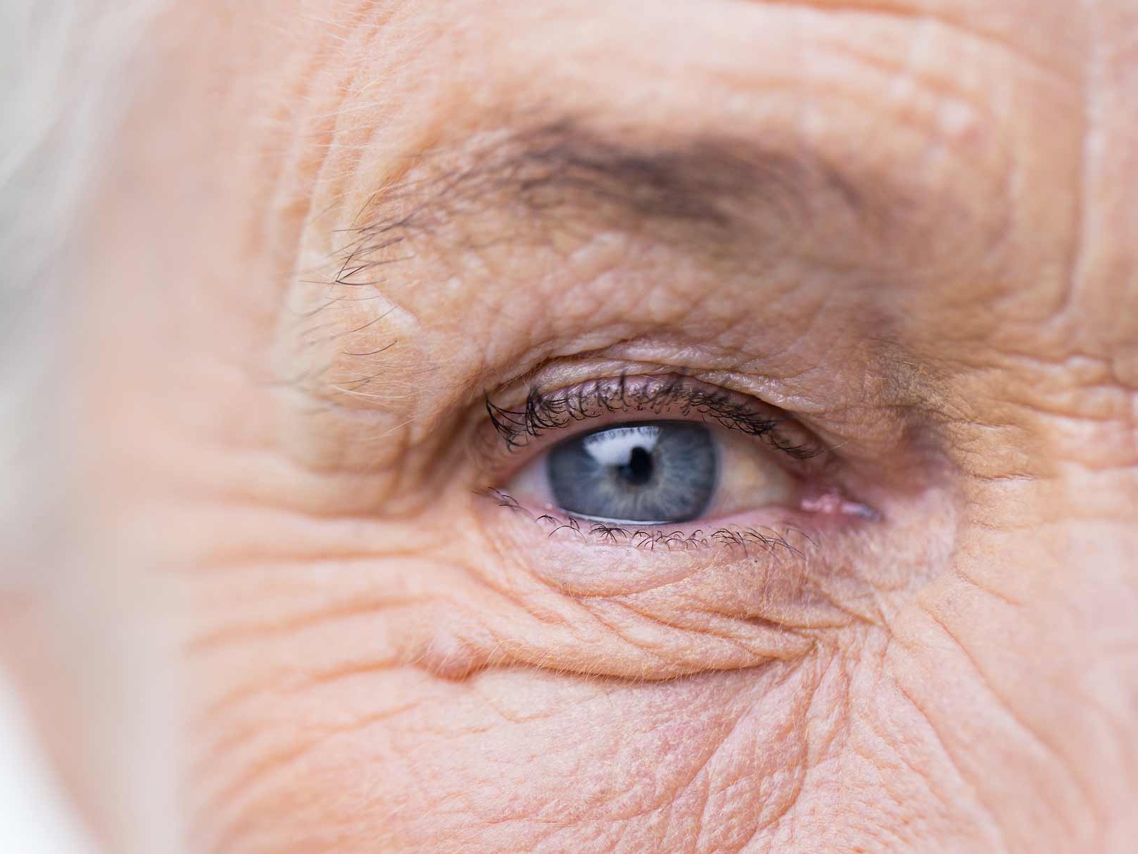 L'immagine mostra il primo piano di un occhio malato, che illustra potenziali pericoli per gli annessi oculari. 